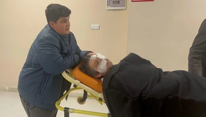 Sivas Ziraat Odası genel sekreteri saldırıda ağır yaralandı